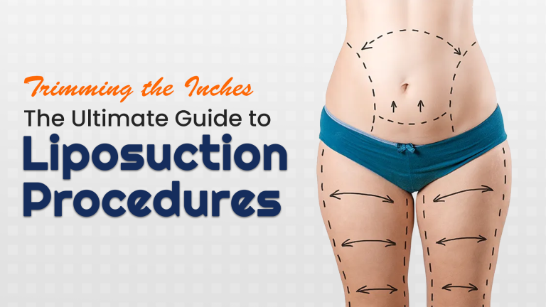 Trimming the Inches: The Ultimate Guide to Liposuction Procedures