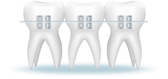 orthodontists Singapore