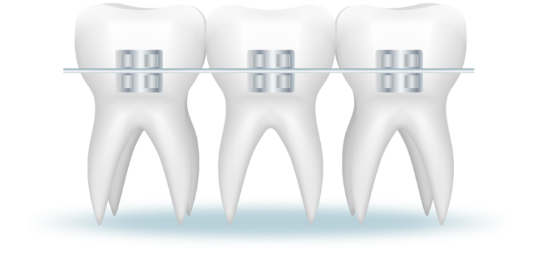 orthodontists Singapore