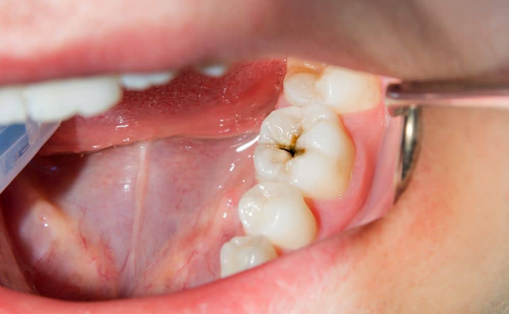 Dental