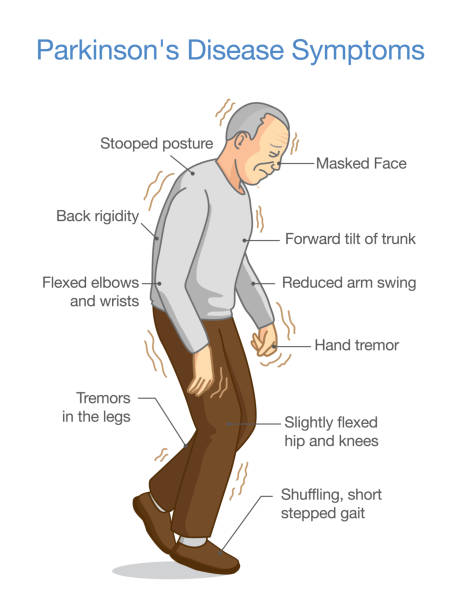 Parkinson’s Disease