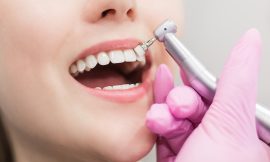 The Power of a Clean Smile: Understanding Teeth Scaling and Polishing