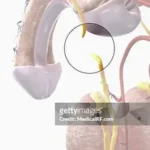 No Scalpel Vasectomy: How It Compares to Traditional Vasectomy