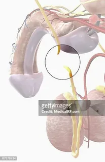 No Scalpel Vasectomy