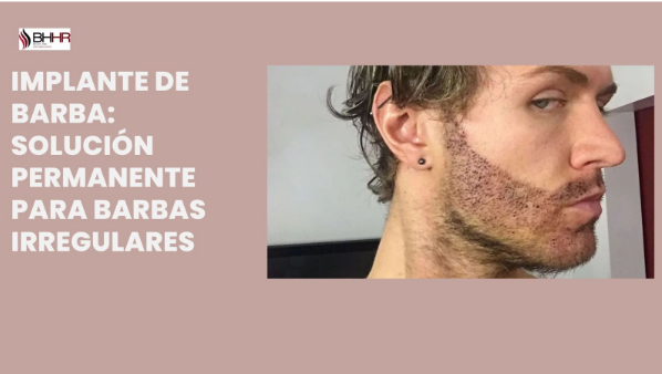 Implante de Barba